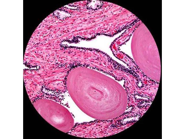 Compound Trinocular Microscope with WF10x WF16x WF20x Eyepieces 40X-2000X Magnification O1142