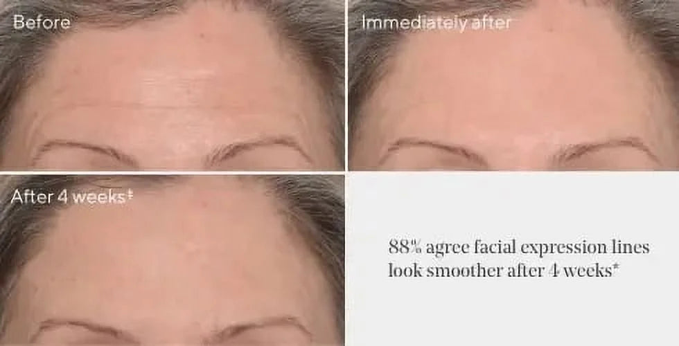 Wrinkle Corrector B36701